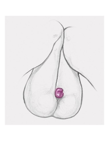 Anillo Gring XL Sweet Raspberry